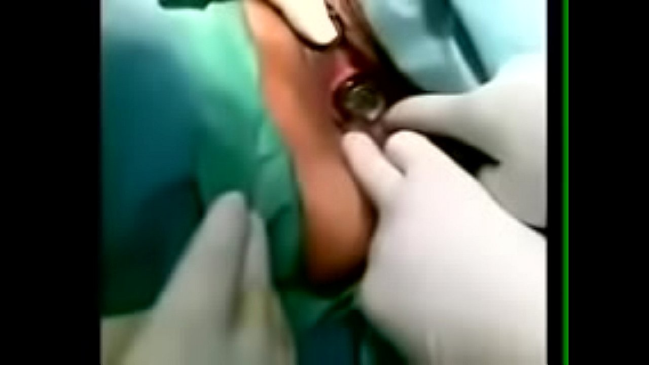 Horny Iranian girl used a bulb as a dildo, Ended up in the Hospital